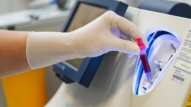 Pflegekraft fügt eine Blutprobe in ein Analysegerät ein