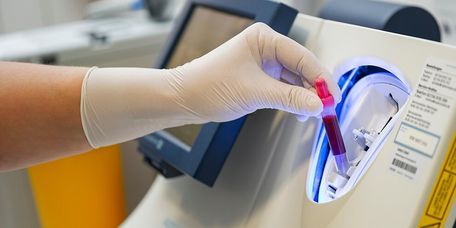 Blutanalyse Pflegekraft fügt eine Blutprobe in ein Analysegerät ein